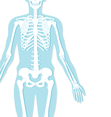 mannequin showing examples of different regions where MSD occurs. neck, shoulder, low back, and wrist are highlighted.